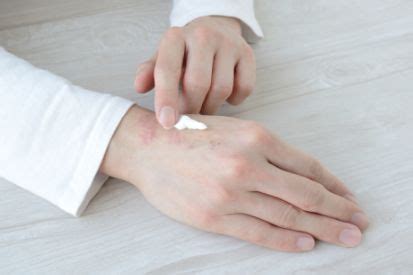 Dry Skin: Symptoms and Treatment | Keystone Dermatology | Philadelphia, PA
