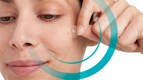 fotos mit compeed anti pickel patches compeed anti pickel patches