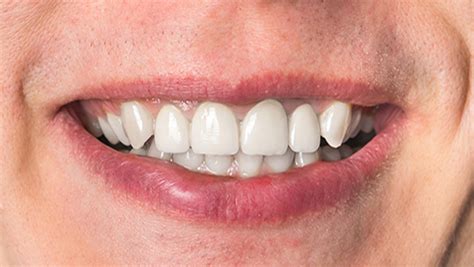 Best Dental Clinics Nairobi & Mombasa - Molars Dental Practice