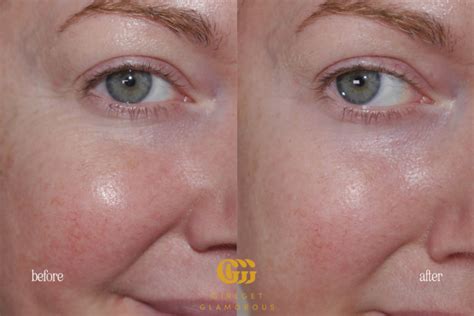 The Best Eye Patches for Smoothing Under Eye Bags • GirlGetGlamorous
