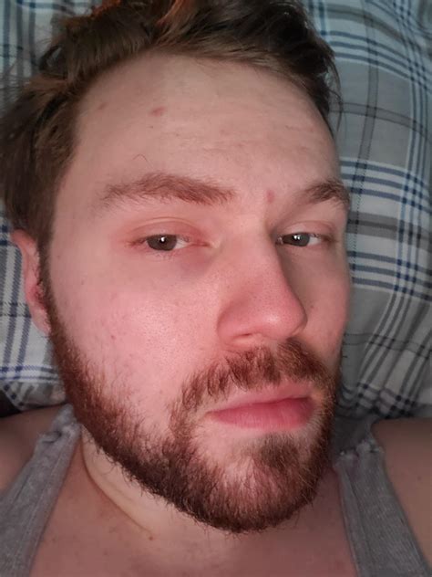 Advanced tools might replace super blackheads at spa loan nguyen 2