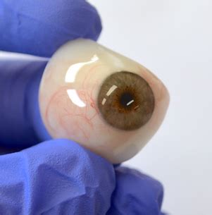 Prosthetic Eye Replacement | Sydney Artificial Eyes Prosthetic Eye Clinic