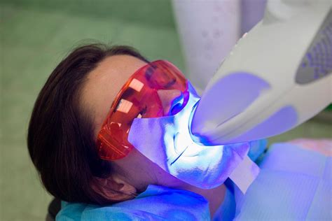 Отбеливание Zoom 4