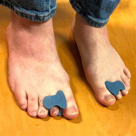 toe spacers correct toes