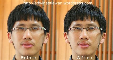 shadow recovery  backlight problem