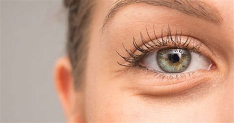 Serotonin Syndrome: 10 Serotonin Syndrome Symptoms