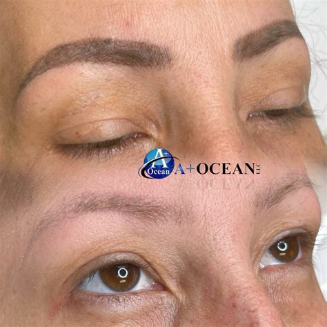 Before & After – A+ Ocean | A+ Ocean LLC