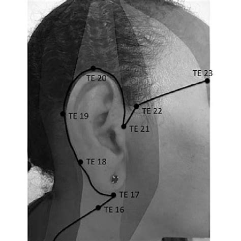 Original drawing from Head's first paper showing Head zones together ...