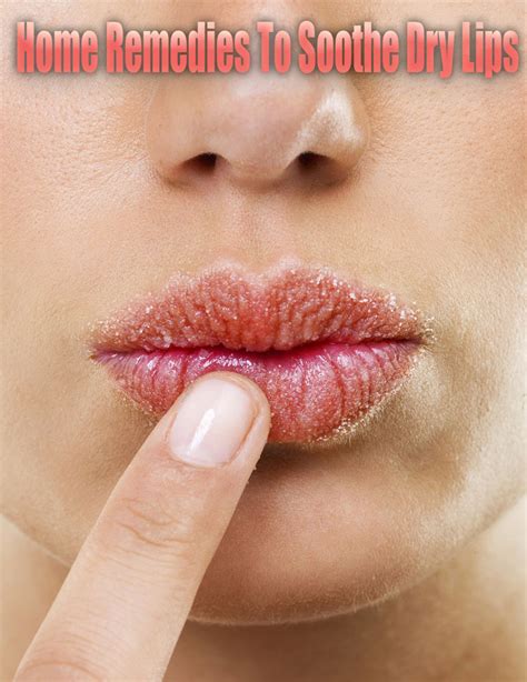 Soothe Dry Lips: Effective Remedies and Prevention Tips - Hunter Games Magazine