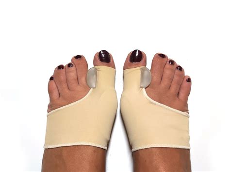 Do Bunion Surgery Doctors Do Both Feet for Surgery?
