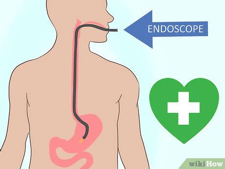 How to Treat a Bleeding Ulcer: 14 Steps (with Pictures) - wikiHow