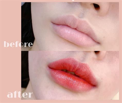 forum phun celebrity extra: Before & After Photos That Will Shock You - kki58bk