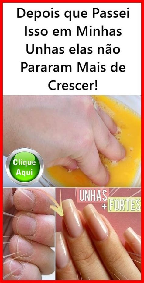Unha Que Não Cresce - Depois que Passei Isso em Minhas Unhas elas não Pararam Mais de Crescer ...