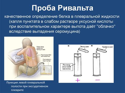 Основы частной патологии органов дыхания - презентация онлайн