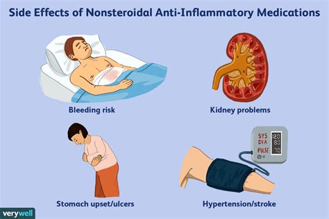 What Is the Best Anti-Inflammatory Medication (Nsaid)?