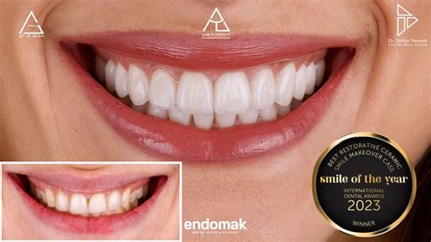 Endomak Dental Clinic added a new... - Endomak Dental Clinic