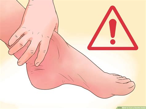 how to take care of a swollen ankle