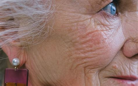 6 Wrinkle Prevention Tips You Need To Know - LooksGud.com