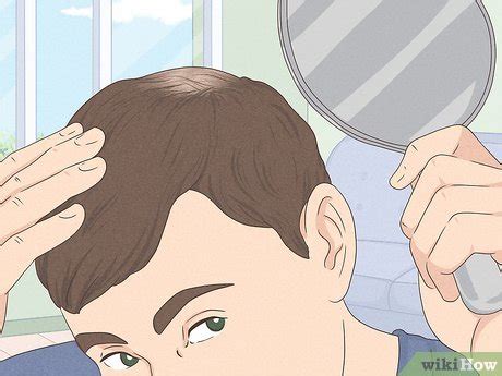 how to know if you have male pattern baldness