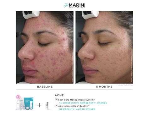 Jan Marini Skincare Treatments - Lititz & Lancaster, PA - Iconic ...