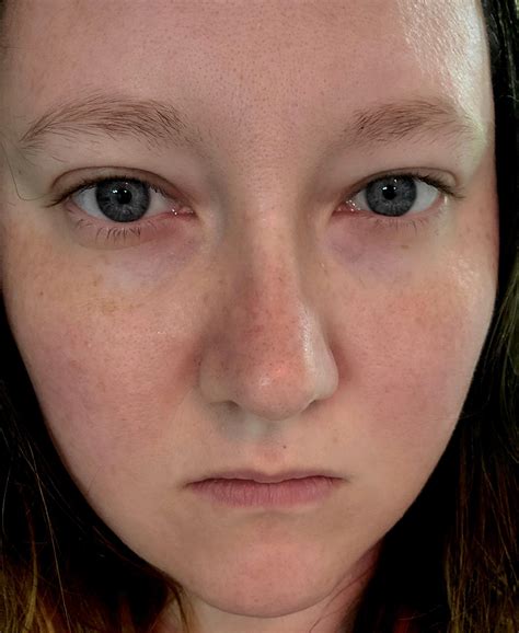 numb face on one side 4