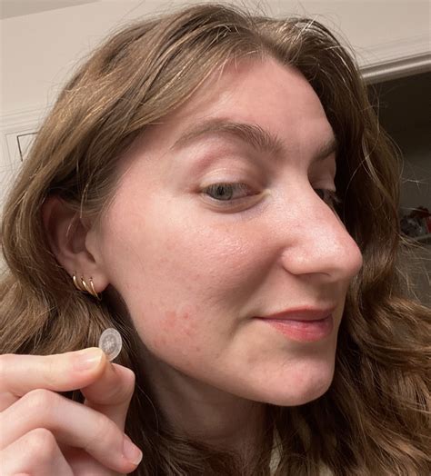SOS: 3 Reasons Why These Zit Dots Belong In Your Emergency Blemish Kit