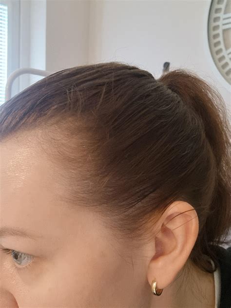 New vitamin formulas will change how do you get thicker hair 11