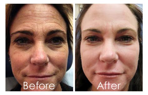 Korean Collagen Firming Mask – Geniwo