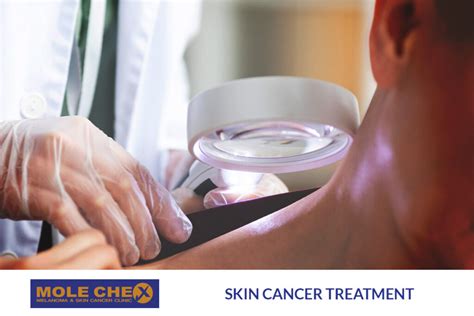 Best Practice Skin Cancer Treatment: Ensuring Effective Cancer ...