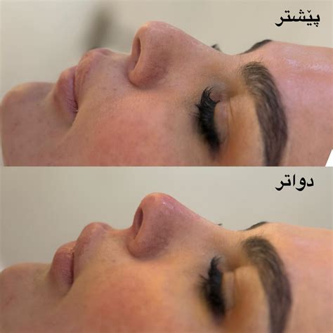 dktr hzhar hmondy  drhazharclinic instagram