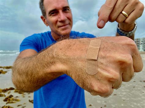 Deadly 'flesh-eating bacteria' can thrive at the beach. How to stay safe.