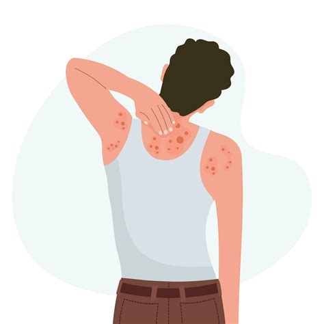 Allergic itching, skin inflammation, redness and irritation. Atopic