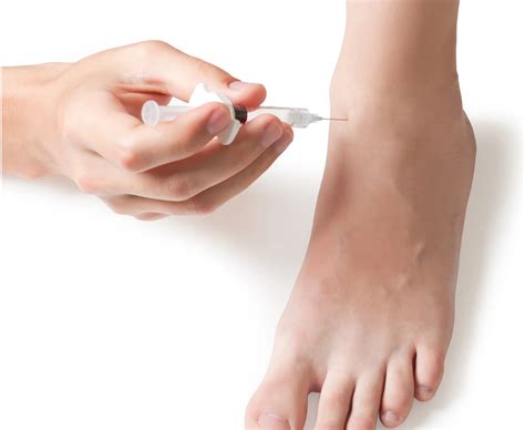 ankle osteoarthritis injections