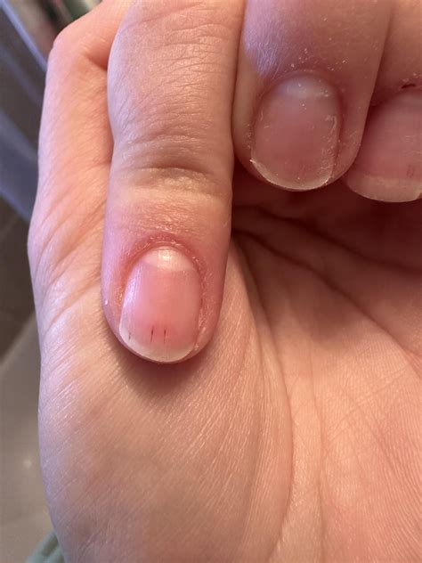 Does anyone know what these little red lines are ? I knooowwwww my