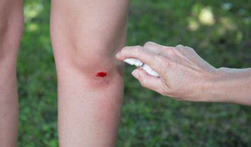wound basics  woundcarecentersorg