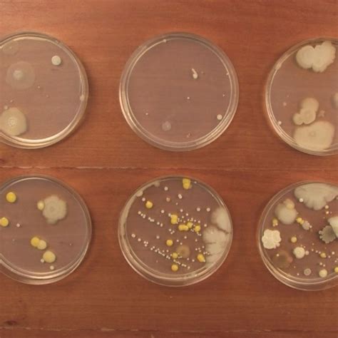 bacteria grow  petri dishes  hilda olivia blog