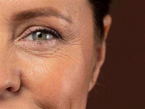 fine lines hydration   fix  infuse