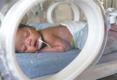 bayi prematur  kecerdasan anakkuid