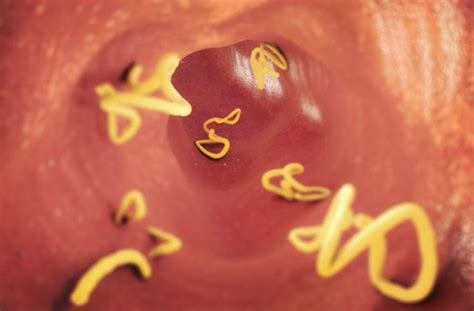 paraziti  tela mizi rychlosti blesku  timto receptem  na vas uz