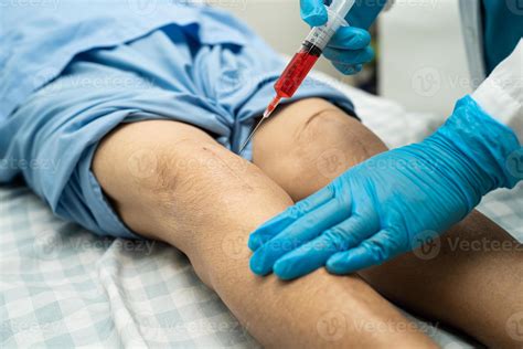Asian doctor inject Hyaluronic acid platelet rich plasma into the knee
