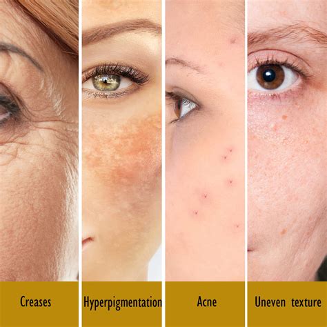 Rosealine Dawnxs' Amazing Results: Before & After Photos Revealed! Image 9
