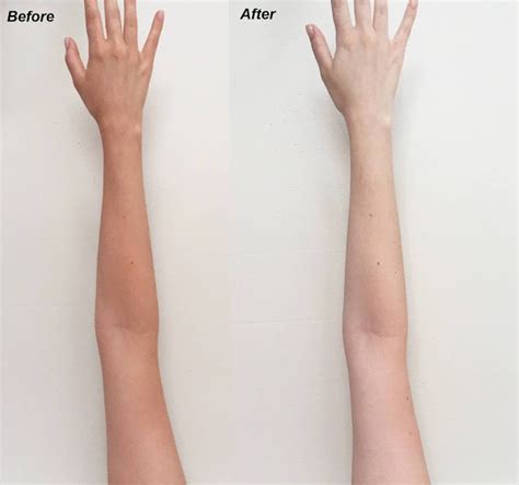 how to clear sun tan