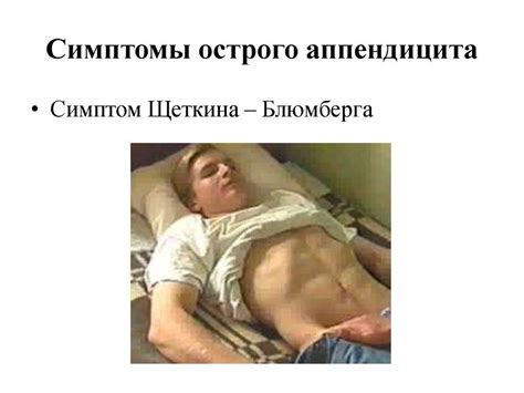 Как понять что у тебя аппендицит: основные симптомы
