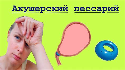 Акушерский пессарий при беременности. Короткая шейка. Показания. За и ...