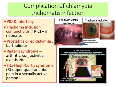 Clinical microbiology : Chlamydia trachomatis an overview of STD's