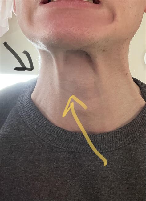 Tendons (?) popping out when I pull my lower jaw in, can someone