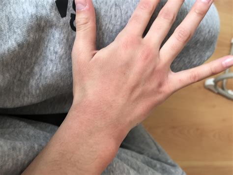 i washed my hands so much it gave me dryed skin.My Muda said u wahed yo
