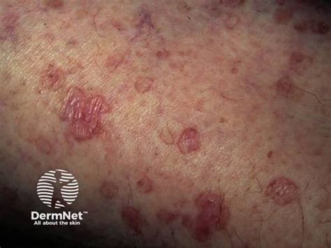 disseminated synonym spread  simple simple  tense  spread