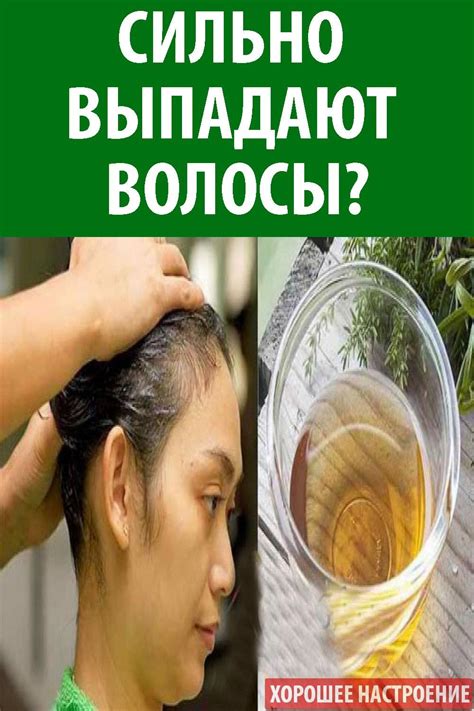 Сильно выпадают волосы? - | Выпадение волос у женщин, Средства от ...