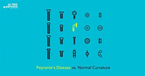 peyronies disease treatment bent curved penis mens health clinic